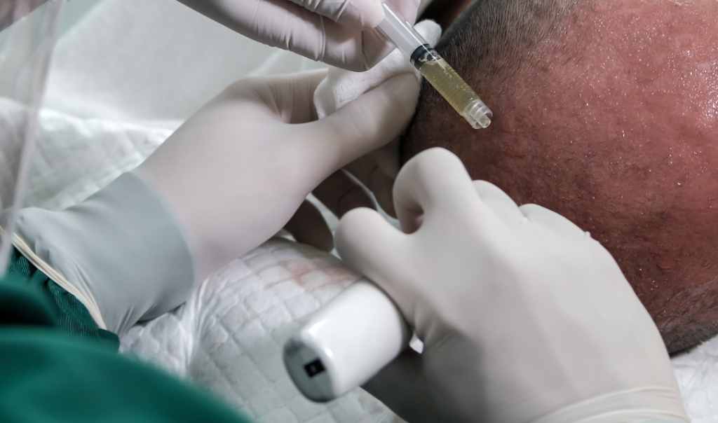 PRP(Platelet Rich Plasma)