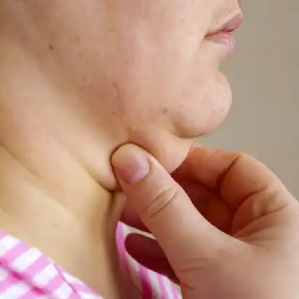 Double-Chin-Reduction-2-1