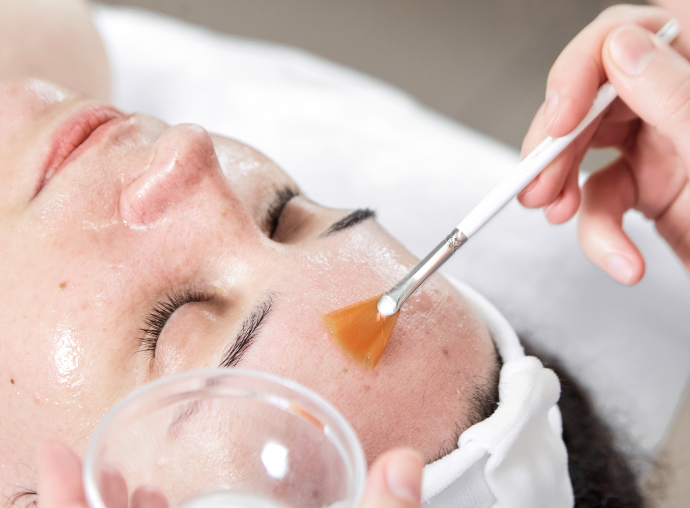 Different Types of Chemical Peels