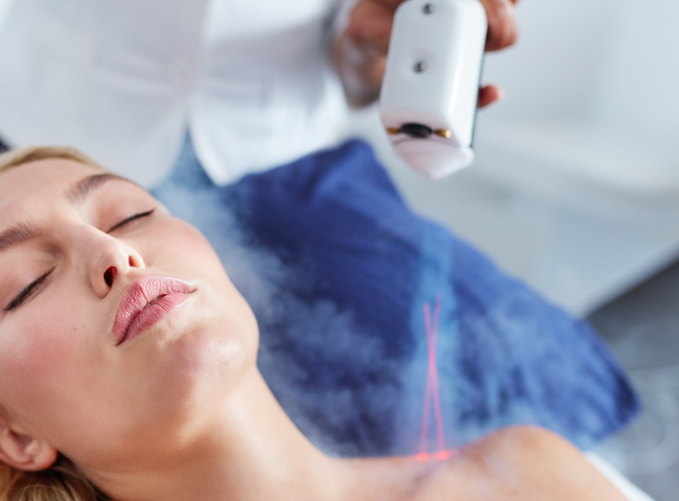 cryotherapy treatment (1)